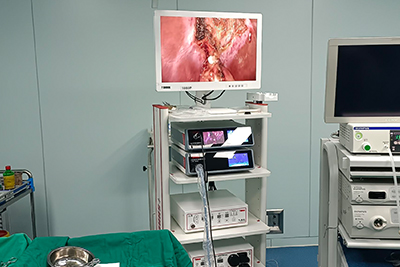 【General Surgery Laparoscopy】