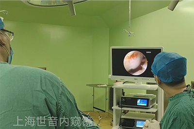 【Orthopedic Arthroscopy】Arthroscopic osteochondral autografting