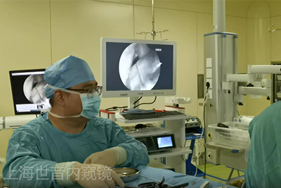 【Orthopedic Arthroscopy】Intra-articular loose body removal