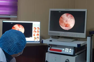 【Ovology Laparoscopy】Hysteroscopy under hysteroscopic fallopian tube hysteroscopy