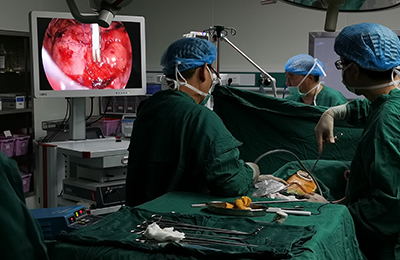 [Thoracoscopic Thoracic Surgery] 4K ultra-high definition thoracoscopy for major thoracic resection of lungs