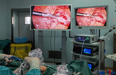 [General Surgery Laparoscopy] 4K Ultra HD Laparoscopic Appendectomy