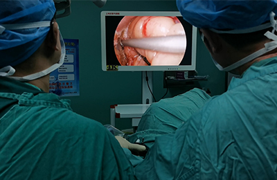 [General Surgery Laparoscopy] 4K ultra-high definition laparoscopic radical resection of low rectal cancer