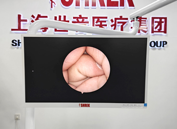 ENT Treatment Unit SY-ENT0720A Gallery