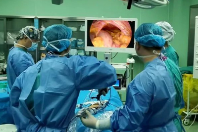 [General Surgery Laparoscopy] 4K ultra-high definition laparoscopic hiatal hernia repair