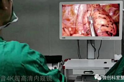 [Thoracoscopic Surgery] Thoracoscopic Radical Resection of Lung Cancer