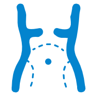 Laparoscopy