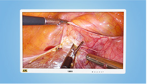 4K Medical Monitor