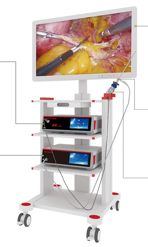 4K Ultra High Definition Endoscope Camera