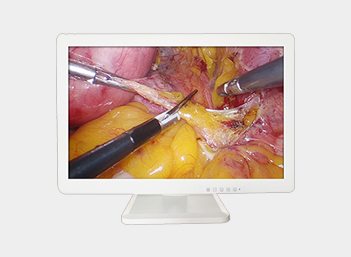 4K UHD Medical Endoscope Monitor 43＂ Gallery