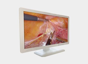 4K UHD Medical Endoscope Monitor 43＂ Gallery