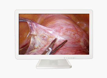 3D Medical Endoscope Monitor 32＂ Gallery