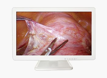 Medical FHD Endoscope Monitor 32＂ Gallery