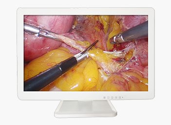 Medical FHD Endoscope Monitor 27＂ Gallery