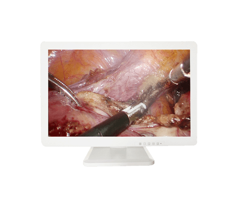 1920*1080P FULL HD SDI CAMERA Medical and industrial Surgery