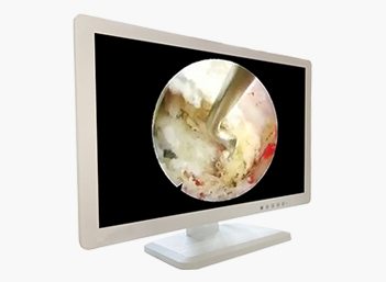 Medical FHD Endoscope Monitor 24＂ Gallery