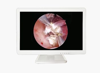 Medical HD Endoscope Monitor 21＂ Gallery