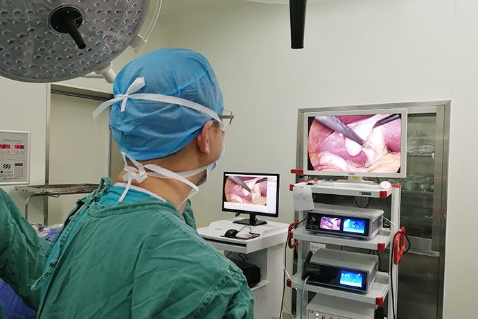 Laparoscopy Exploration