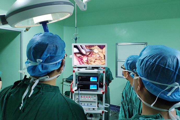 Laparoscopy Exploration