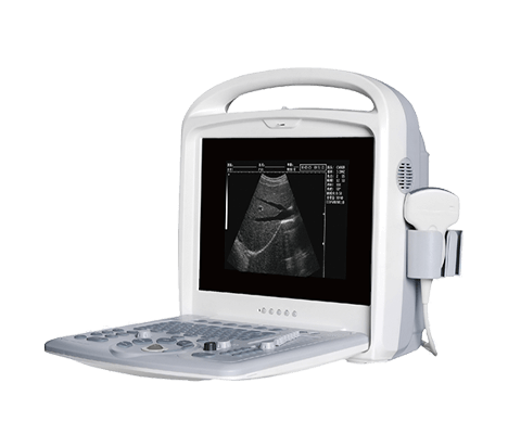 Ultrasound Imaging System