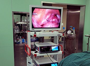 Medical FHD Endoscope Camera Gallery