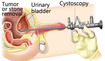 Veterinary Cystoscopy Medical Diagnosis Endoscopy Camera Medical